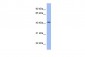 PRPSAP2 Antibody - N-terminal region